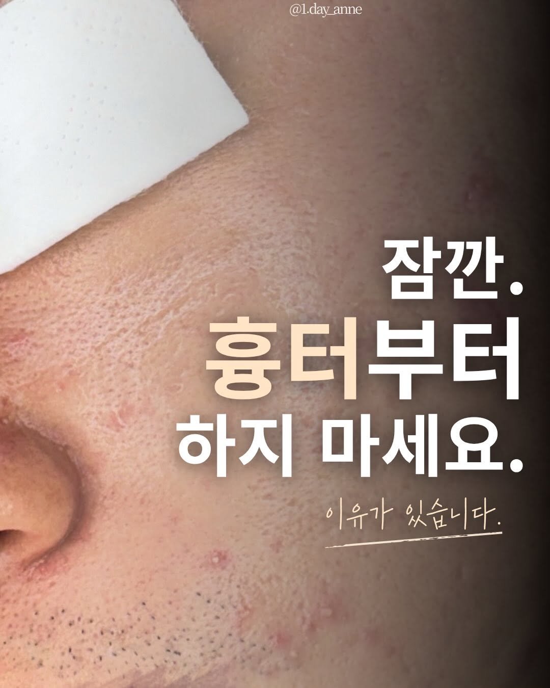1.day_anne 게시물 이미지: 많은 분들이
눈에 보이는 문제부터 관리합니다.

이 고객님 역시 여러 관리를...