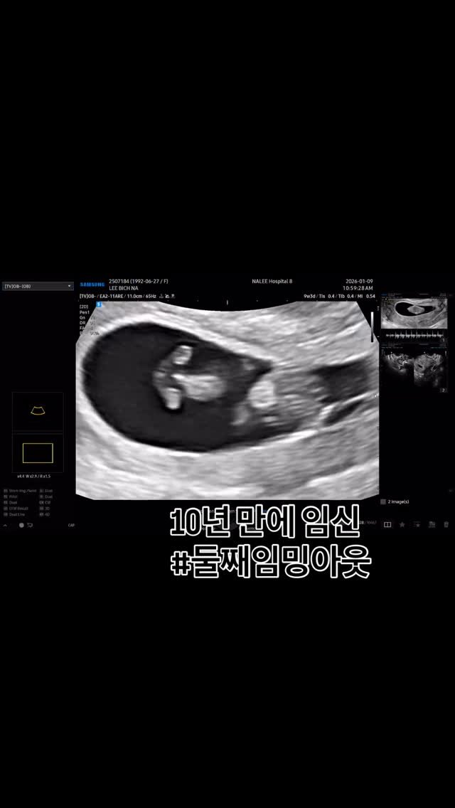 157cm_fitgirl 게시물 이미지: 10년만에 다시 임신..🤰

”둘째는 없다.“ 다짐했는데..
요즘 오빠랑 아기만...