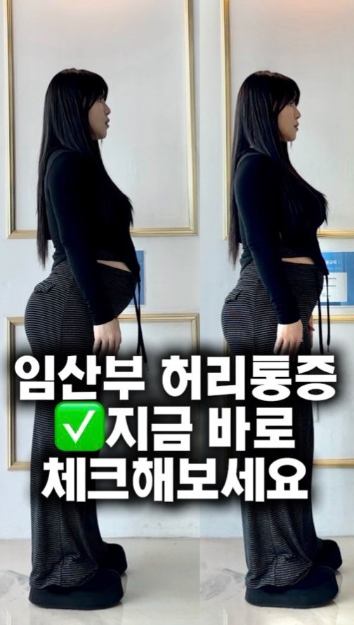 157cm_fitgirl 게시물 이미지: 임신하고 허리 아픈 분들 많으시죠🥲

배가 나오면서
몸 중심이 앞으로 쏠리고
허리가...