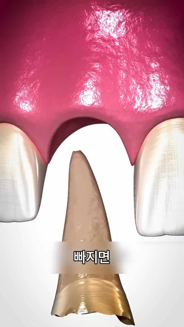 1993.windmill 게시물 이미지: 와 진짜 조심해야됨..

좋아하는 빵도 못먹음 ㅜㅜ...