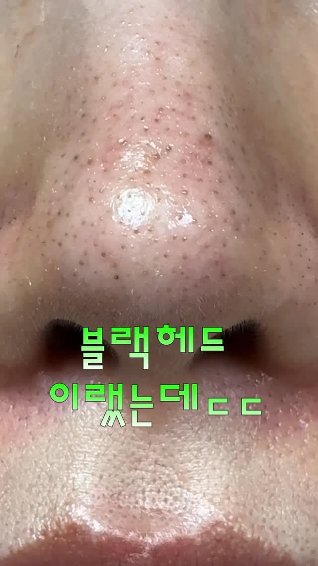1star2star_ 게시물 이미지: 아직도 코 더러우셔요..?👃