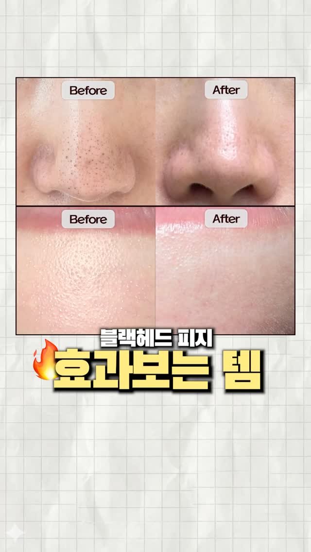 1star2star_ 게시물 이미지: #광고 블랙헤드 피지 요철 기강잡는 템👇

@paulaschoice_kr...
