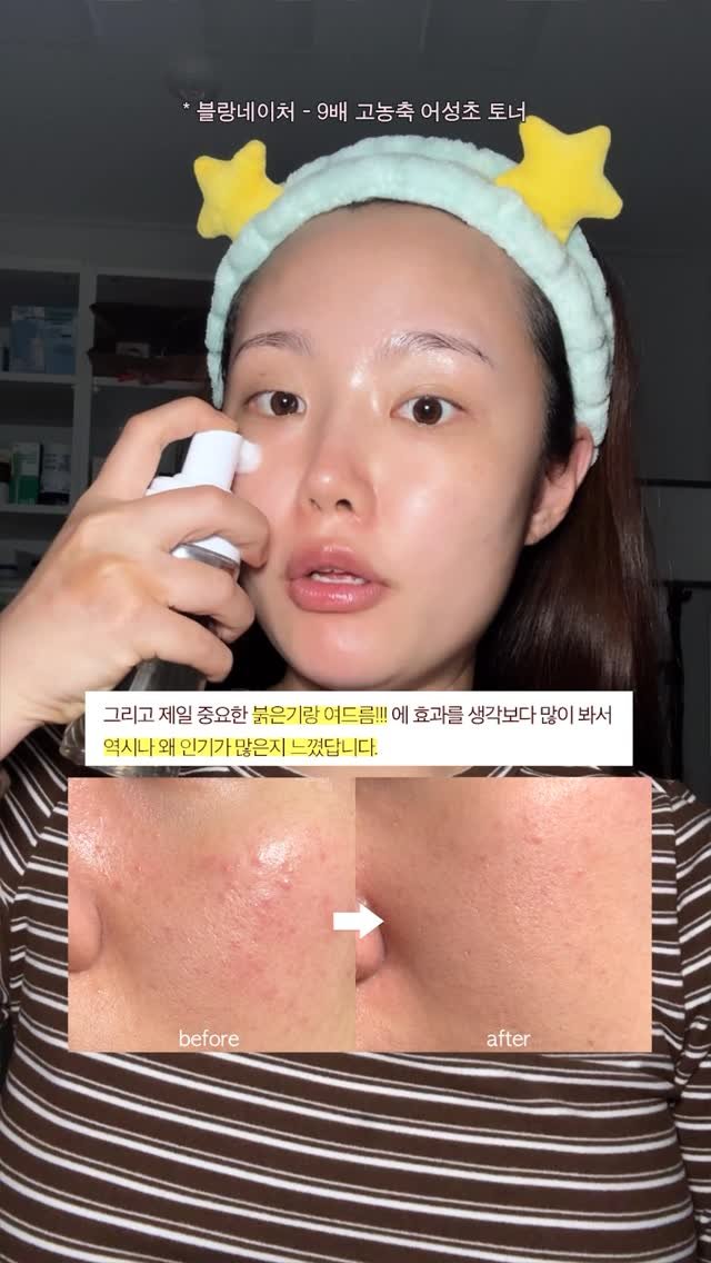 1star2star_ 게시물 이미지: 🌟역대급 후기 읽으면서 토너 발라보기🌟

➡️마켓입장링크 : 프로필 링크

이번...