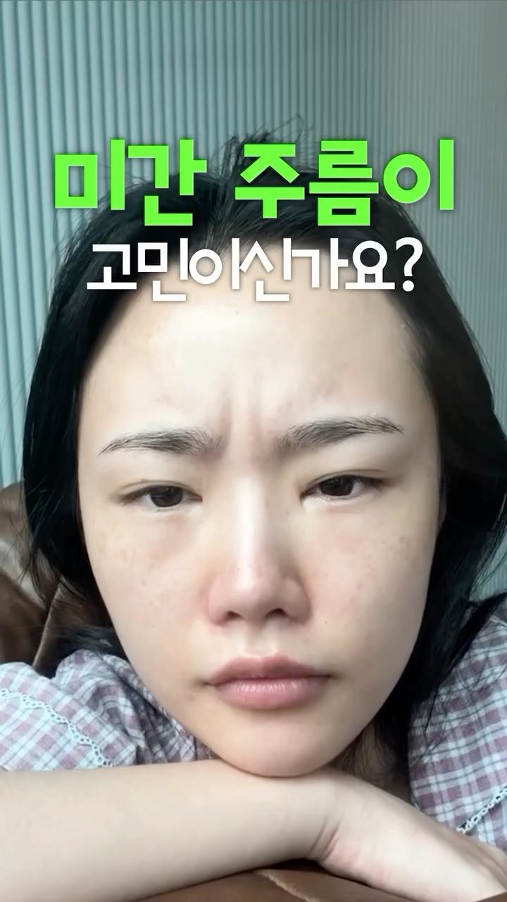 1star2star_ 게시물 이미지: 보톡스 아님❌ 미간주름 간단하게 관리하는 법

(광고) 
하.. 진짜 다년간의...