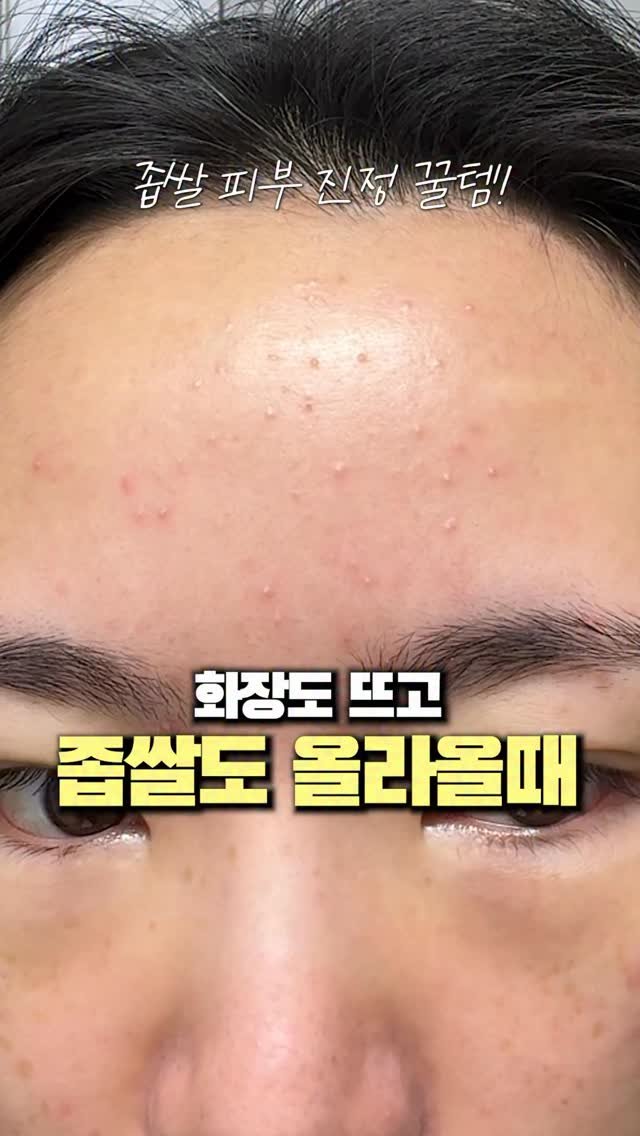 1star2star_ 게시물 이미지: #광고 but 찐템🩷 건조로 인한 홍조, 잔각질, 따가움있는 장벽 얇이진 피부엔...