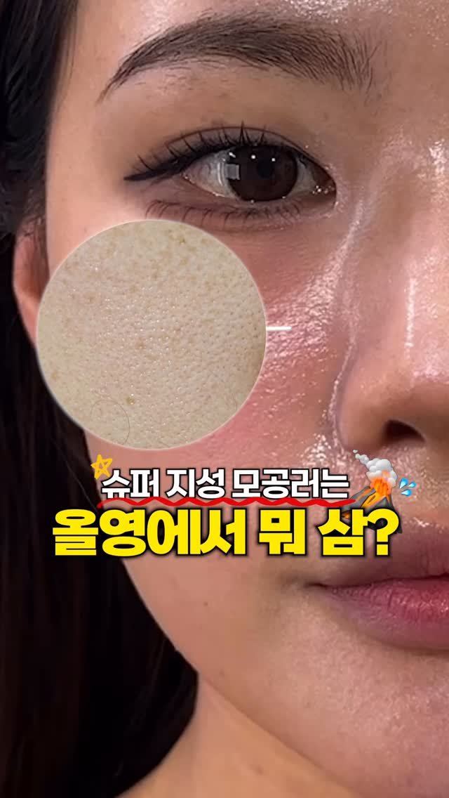 1star2star_ 게시물 이미지: 모공부자들아 이거 꼭 봐 👇..

#광고

저 모공 광고는 진짜 잘 안 하는거...