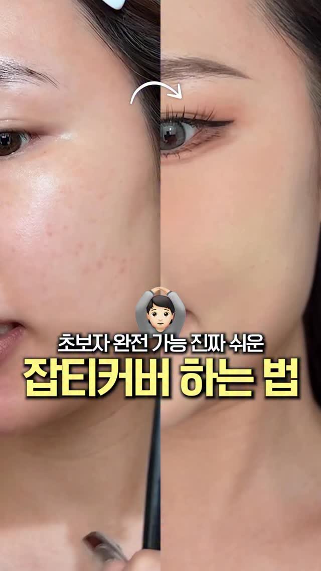 1star2star_ 게시물 이미지: 여드름 잡티커버 쉽게 하는법