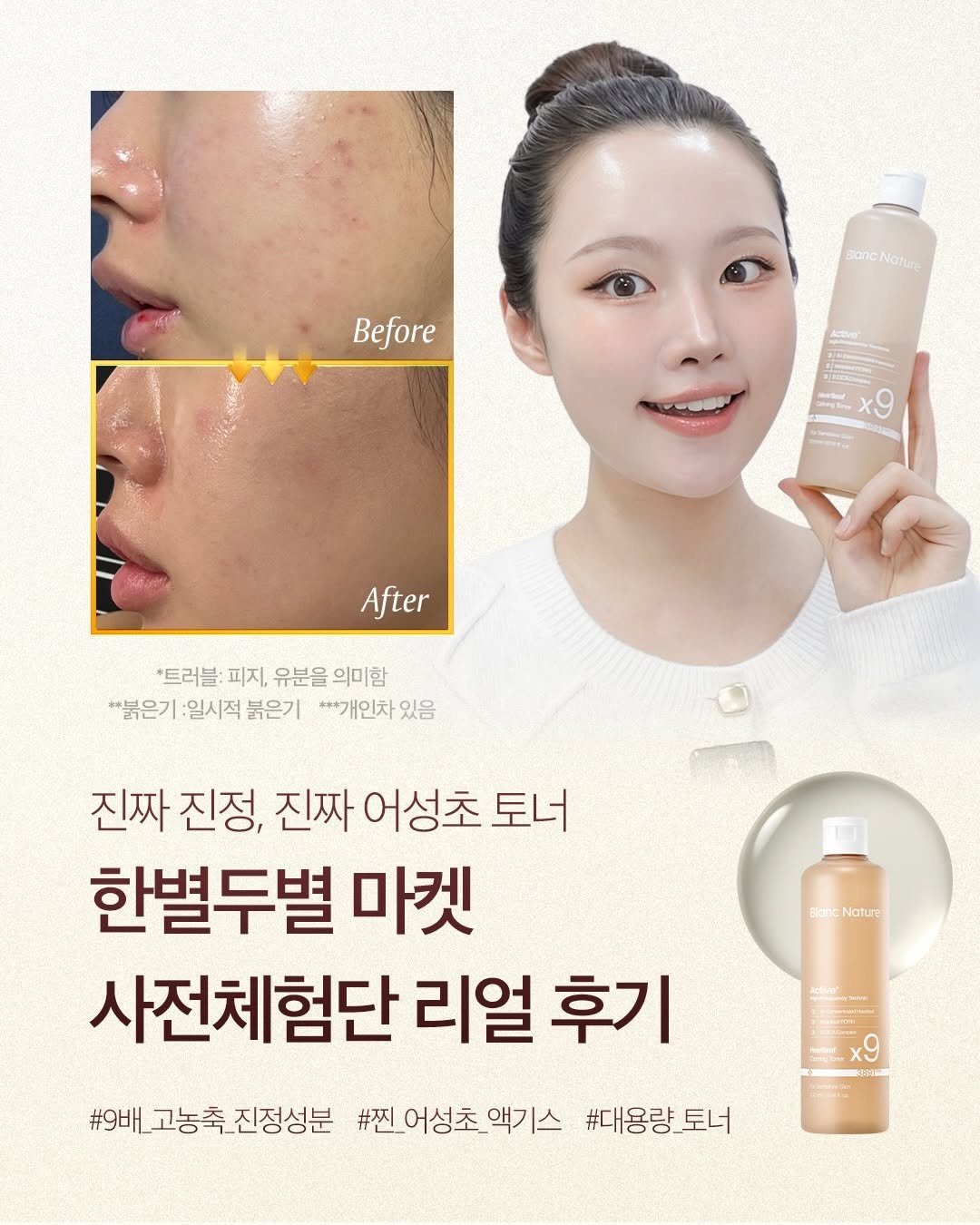 Photo by 한별두별 | 스킨케어•뷰티 크리에이터🤍 on March 28, 2026. May be an image of hair product, lotion and text that says 'Before atncNature 9== a x9 After *트러블: 피지, *트러블:피지,유분을의미함 유분을 의미함 *붉은기 :일시적 붉은기 ***개인차 있음 진짜 진정, 진짜 어성초 토너 한별두별 마켓 사전체험단 리얼 후기 BioncNatue 3 #9배_고농축진정성분 #찐_어성초_액기스 #대용량_토너'.