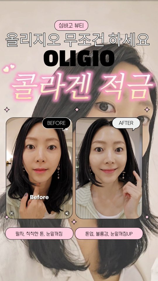 24oldfency 게시물 이미지: #광고

피부 Before vs After 먼저 보실래요?✨️✨️✨️

코인은 못...