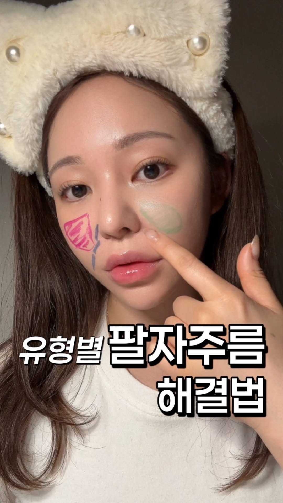 3.18oz 게시물 이미지: 유형별 #팔자주름 해결방법 이예요:)
자기 유형이 어떤건지 파악하고 시술받으러...