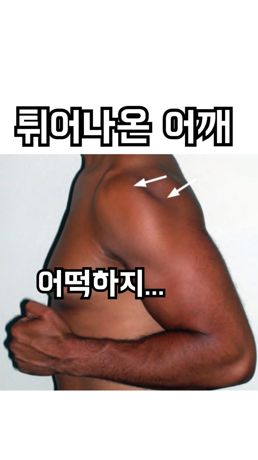 3min_exercisescience 게시물 이미지: 어깨이야기 온라인강의는 프로필 링크트리 어깨이야기로 가시면 등록가능합니다!
피티...