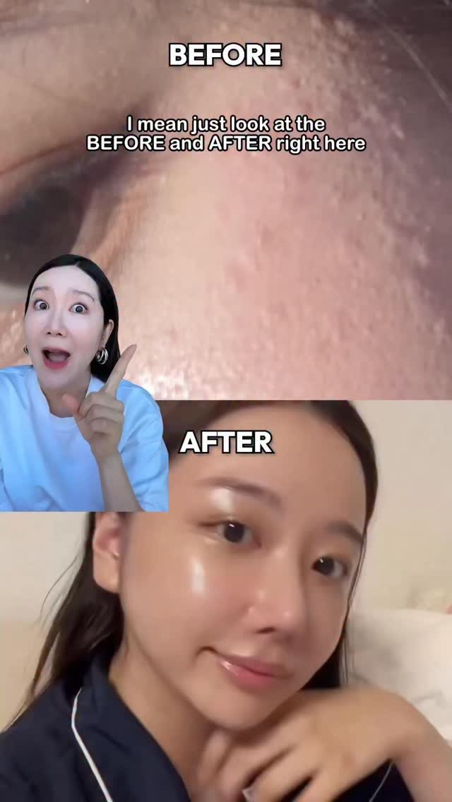 Euniunni 게시물 이미지: 👀 BEFORE → AFTER is CRAZY!! 

The CEO of...