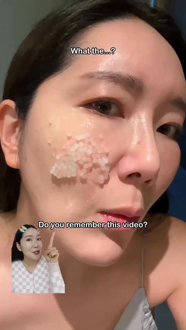 Euniunni 게시물 이미지: I’ve been using this cream for 2+ months and...