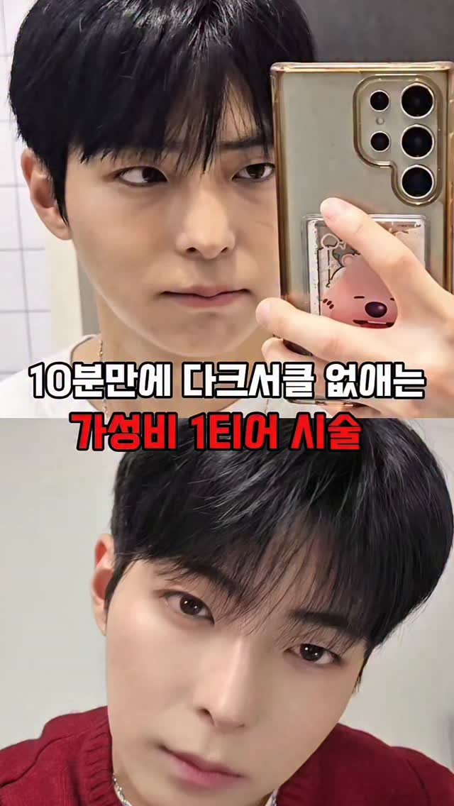 Keon_uuj 게시물 이미지: 다크서클 때문에 고민이라면
👉 단 10분, 나에게 맞는 맞춤 시술로 해결

댓글에...