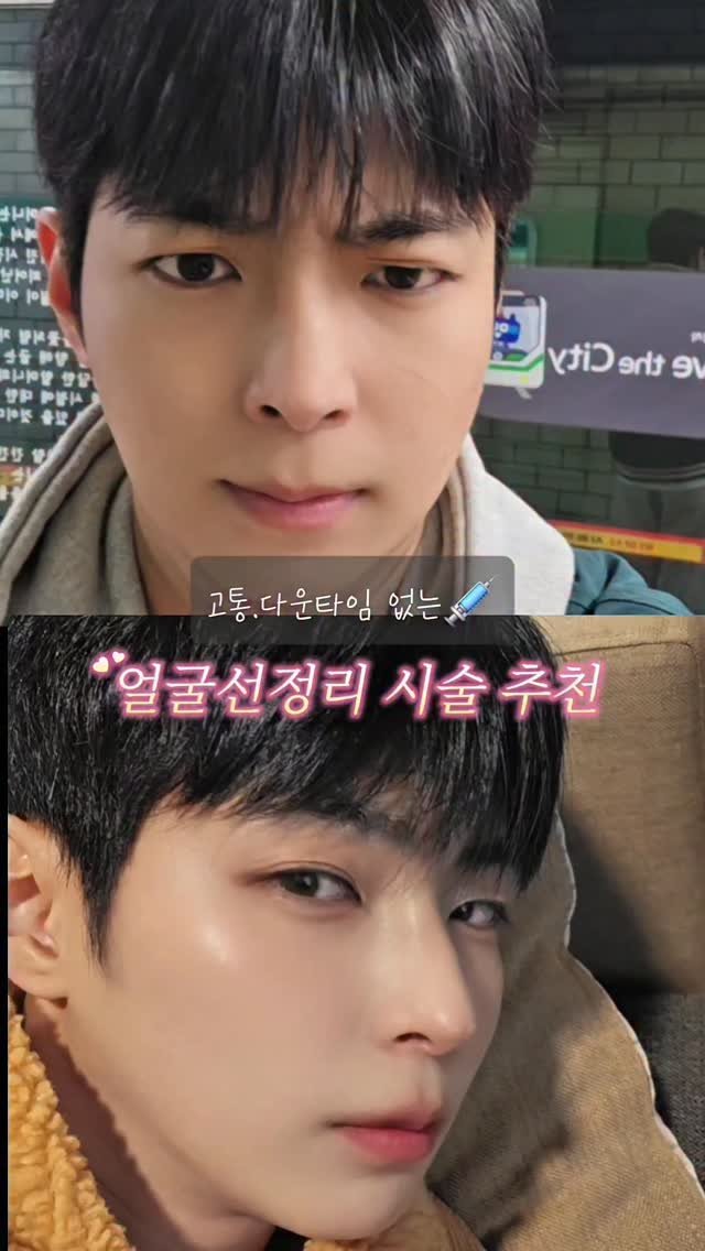 Keon_uuj 게시물 이미지: 제가 꾸준히 챙겨 받는 거의 유일한 시술이 텐써마
연예인들이나 인플루언서들도 많이...