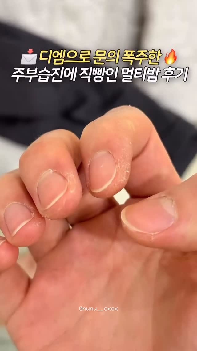 UN_NI_ITEM 게시물 이미지: 연구원들이 만든 화장품은 다르쟈나.. 언니 주부습진 하루만에 좋아진 스토리 보고...