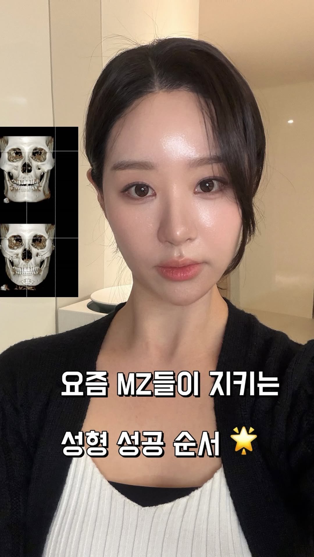 ___seoan 게시물 이미지: ❌성형계획 있다면 꼭 보세요❌
요즘 압구정 로데오 나가면 20살 초반 친구들...