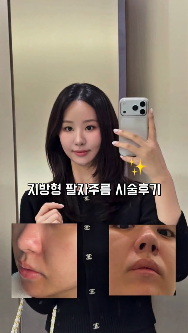 ___seoan 게시물 이미지: 💸내돈내산💸
최근에 살빠지면서 얼굴도 같이 빠지는데 팔자위쪽살은 왜 안빠지는지..?...