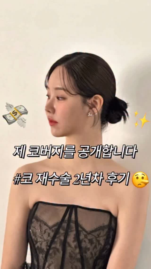 ___seoan 게시물 이미지: 코버지 정보 공유합니다 😗
저 성형 시술 상담 문의 너무 많은데
코 정보 문의가...