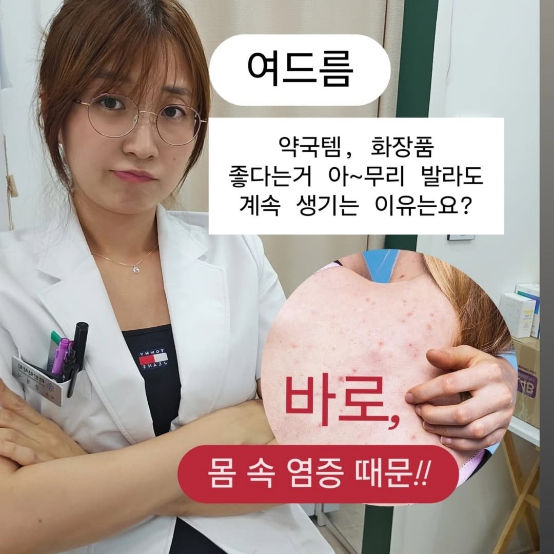 Photo by 강약사 • Pharmacist • 강정이 on August 15, 2025. May be an image of 1 person and text that says '여드름 약국템, 화장품 좋다는거 아~무리 발라도 계속 생기는 이유는요? ИHoT 5 и 바로 몸속 몸속염증때문!! 속 염증 때문!!'.
