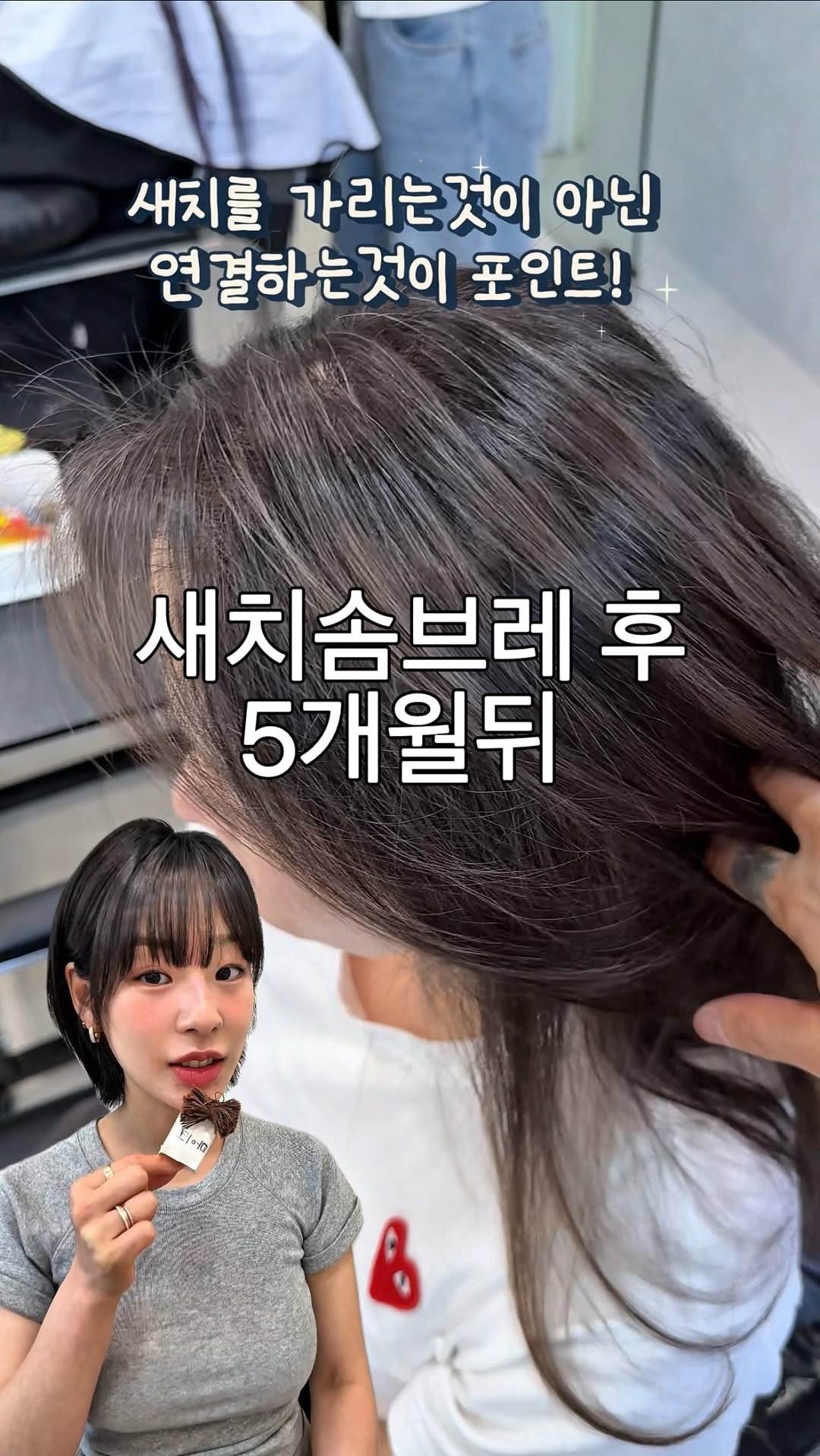 __moonhyewon 게시물 이미지: 첫 새치솜브레 후 5개월뒤 방문해주셨어요🤍

그동안의 관리나 주변지인분들의 반응...