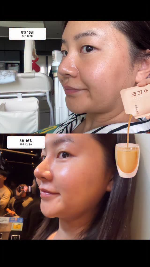 __yooooona 게시물 이미지: 38차까지 와버린..
ㅂㄴㅅ...

시중에 붓기관련 제품들이 지인짜 많잖아요?!
다...