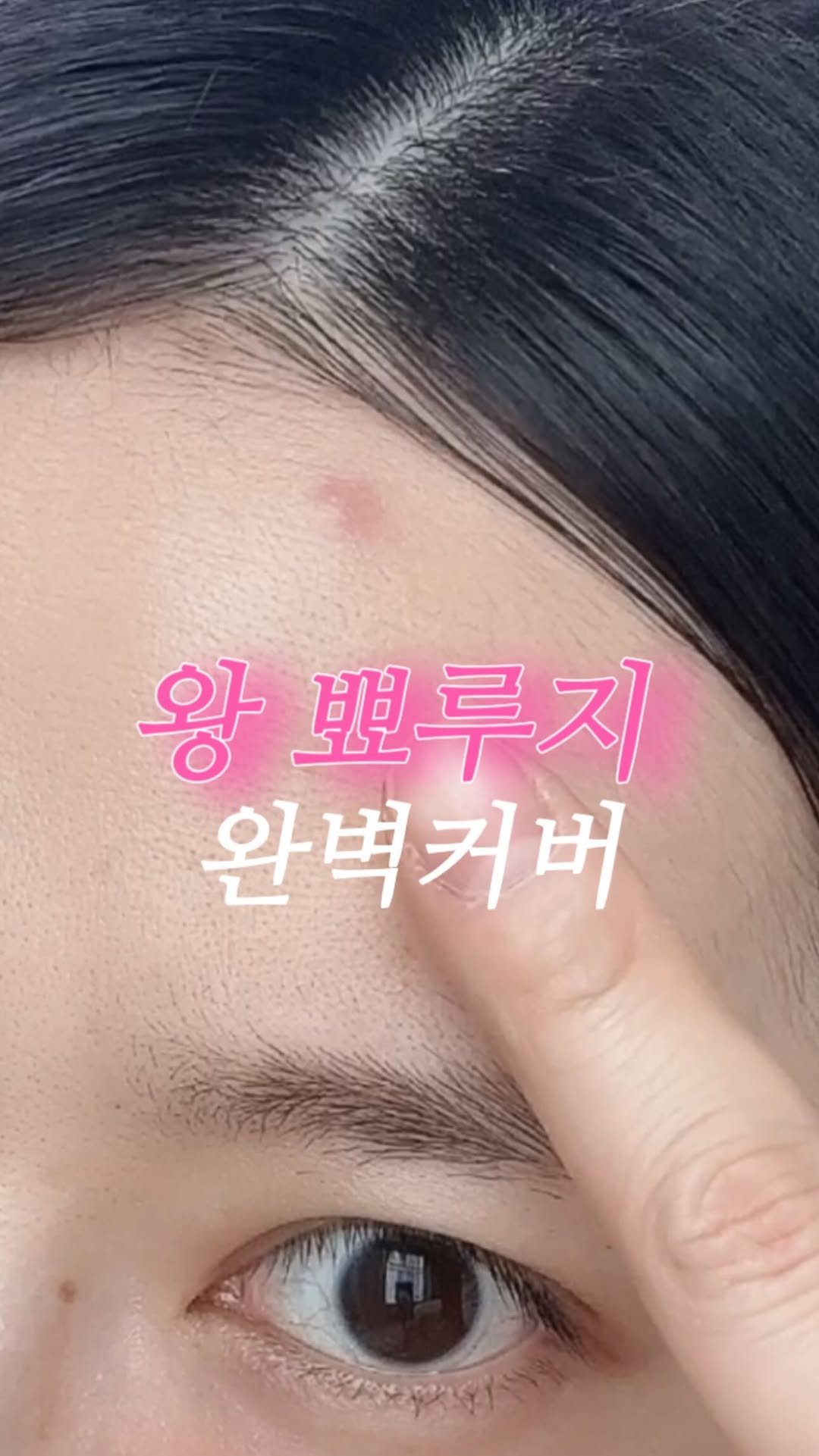_rimply 게시물 이미지: 얼굴 옥의티 없애기❣️ 

패치 요즘 정말 잘 나오는것 같아요!!
트러블 생긴...