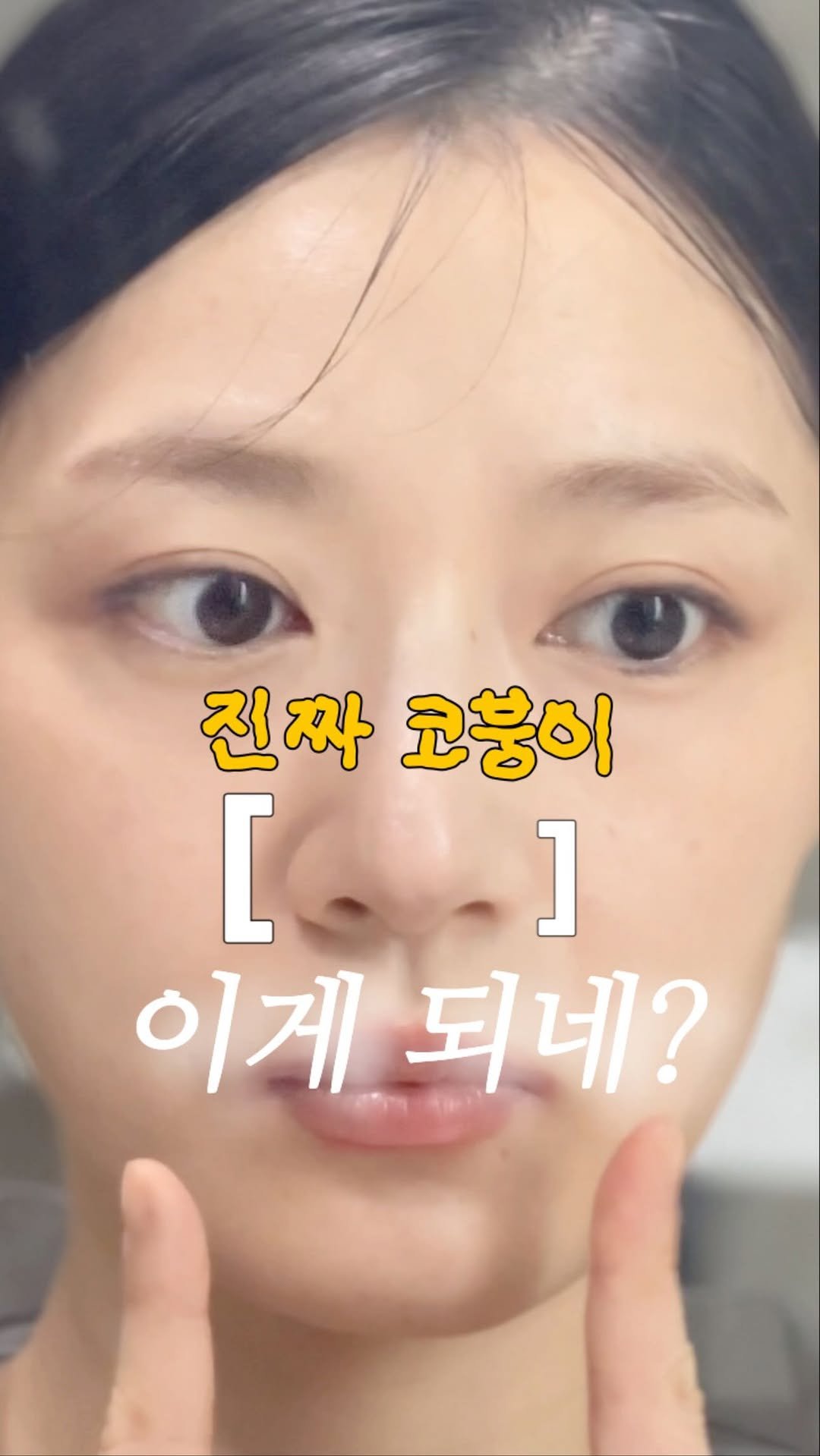 _rimply 게시물 이미지: 👃코붕이👃는 코 줄이기에 진심이거든요

이거 효과 정말 있네요??
근데 영상처럼...