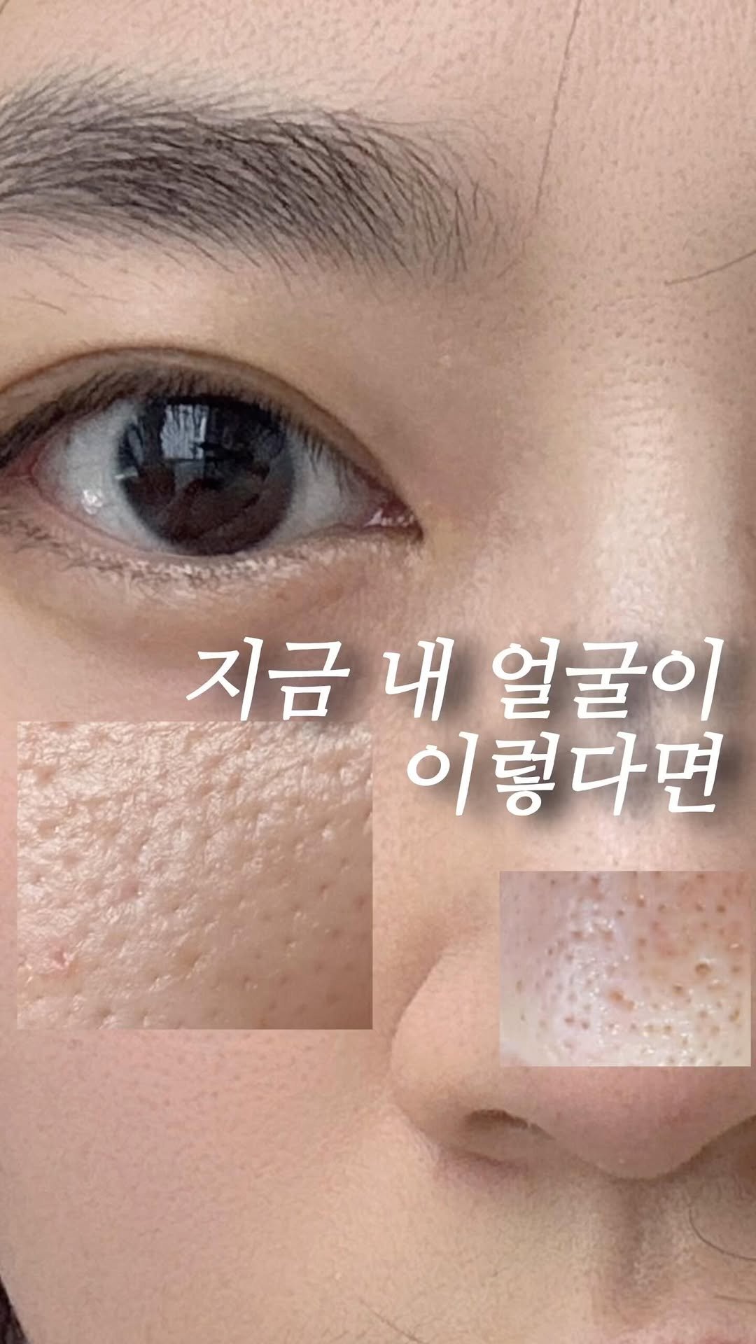 _rimply 게시물 이미지: 👀 엄마… 지렁이 나올 것 같아… 
얼굴에 왜 이렇게 구멍이 많아? 😳 

딸이...