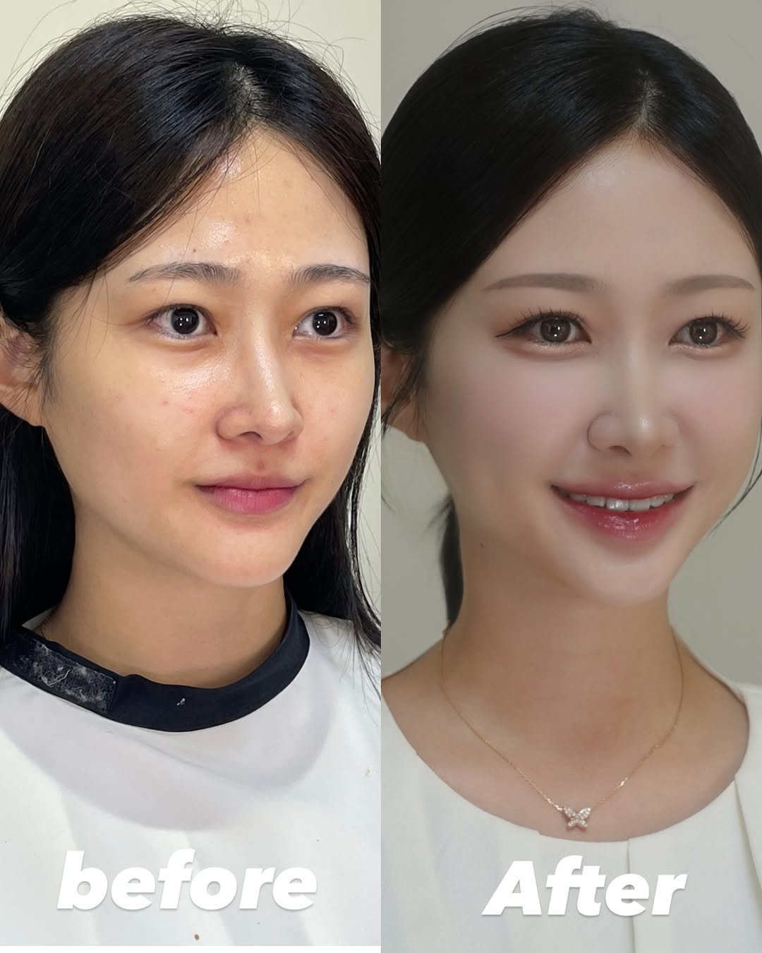 Photo by 𝑈𝑖𝑙𝑦 유일리 대표 승은원장 | 홍대메이크업 연남동메이크업 on January 11, 2026. May be an image of text that says 'before After'.