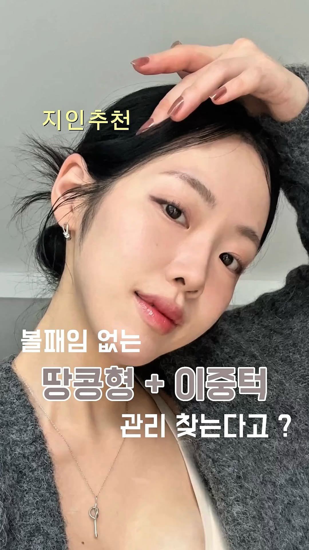 _yeom_ni_s_ 게시물 이미지: 저번에 스토리로 얼굴형&이중턱 고민이라
시술 추천해달라고 했는데 
다들 본인...