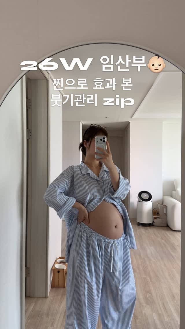 _yuhip 게시물 이미지: 배 눌렀는데 자국 남는거 실화야..?👶🏻💦
이제 진짜x100 관리 부지런히...