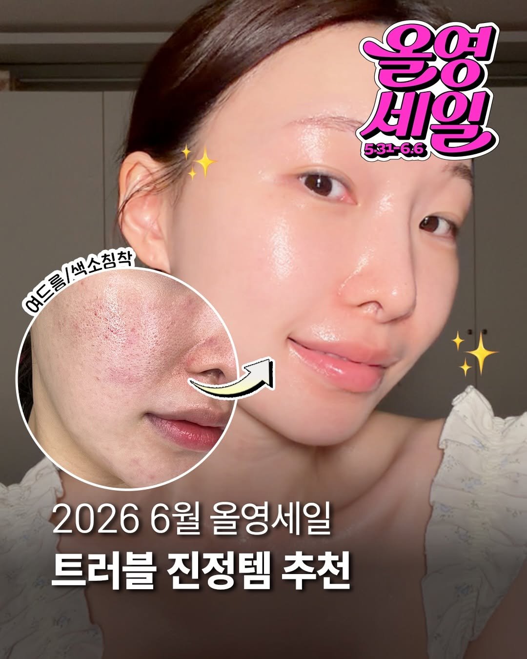 a_arang_ 게시물 이미지: 여러분 올영세일 잘 즐기고 있나용?🩵🩷
여름철이라 덥고 트러블이 올라오는 몰랑이들...