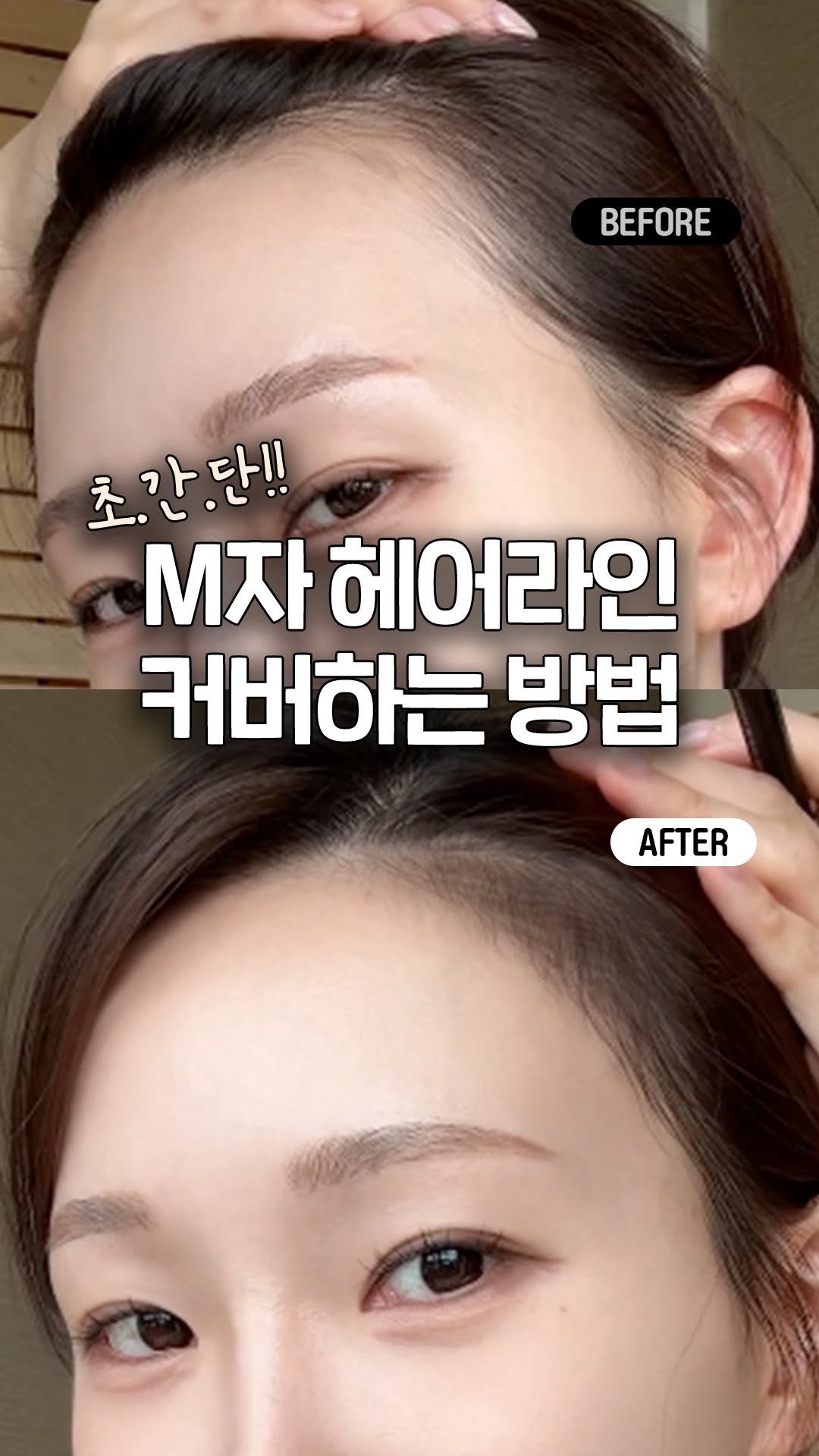 a_arang_ 게시물 이미지: 몰랑이분들💕
제가 사진찍을때나 올림머리할 때
헤어라인이 비어보이면 얼굴형이 커보이는...