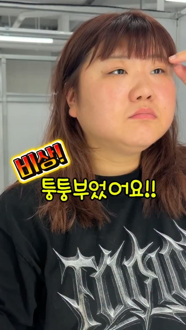 adore_daeyoungyoung 게시물 이미지: @mypackcake 
저는 유명한 붓기인간이거든요😫 
그리고 얼굴 열도 많이 난단...