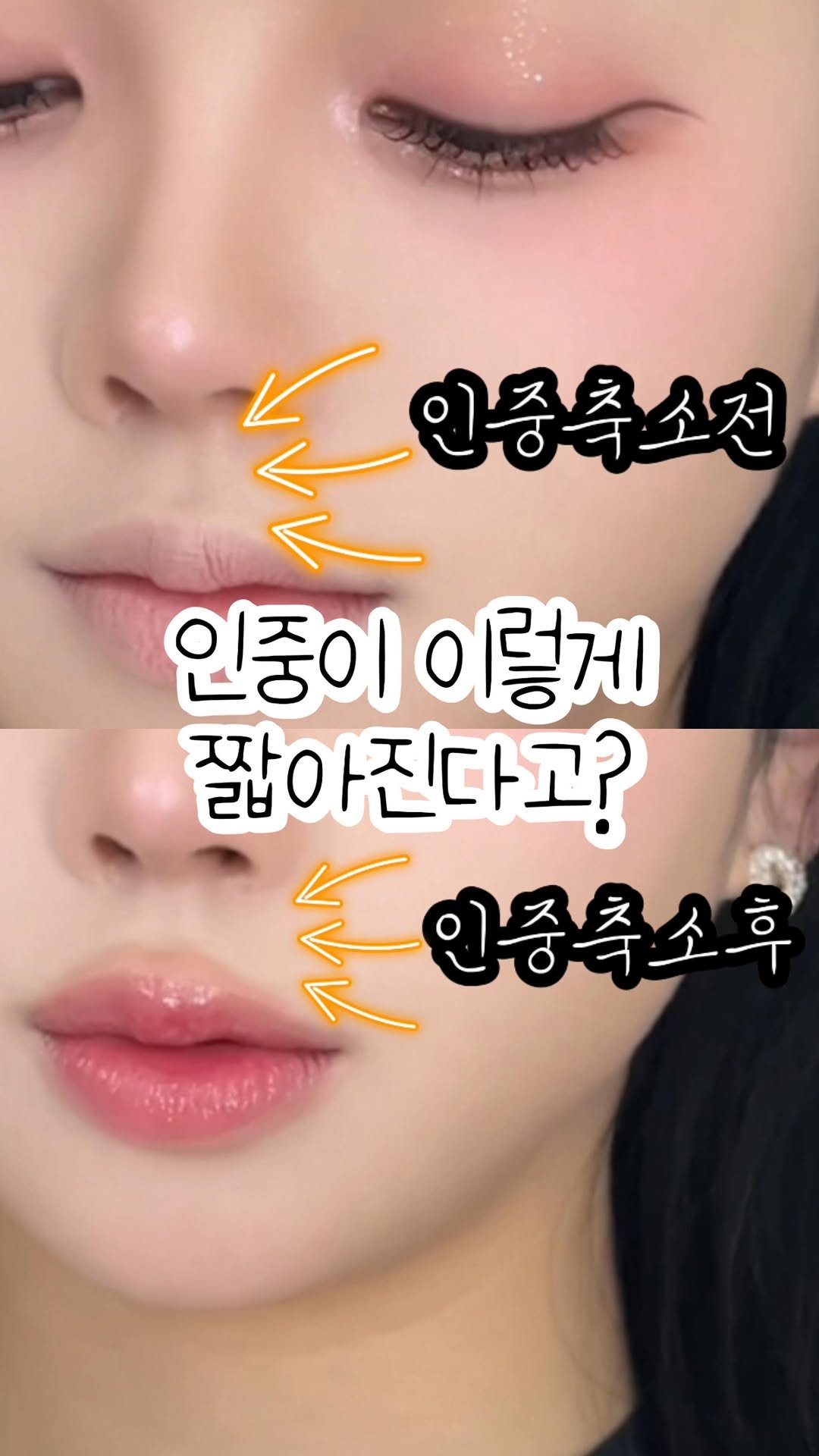 aimable_jooji 게시물 이미지: 인중축소템 콰티 베이스립 공구 Day!
오늘 낮 12시...