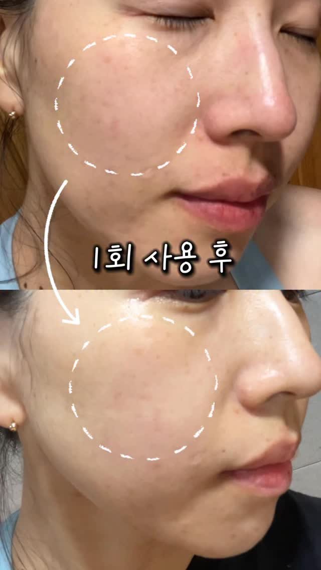 amo__hyunii 게시물 이미지: #광고

📍CKD 비타씨테카 기미잡티샷 마스크

솔직히 마스크팩 협찬 받으면서
...