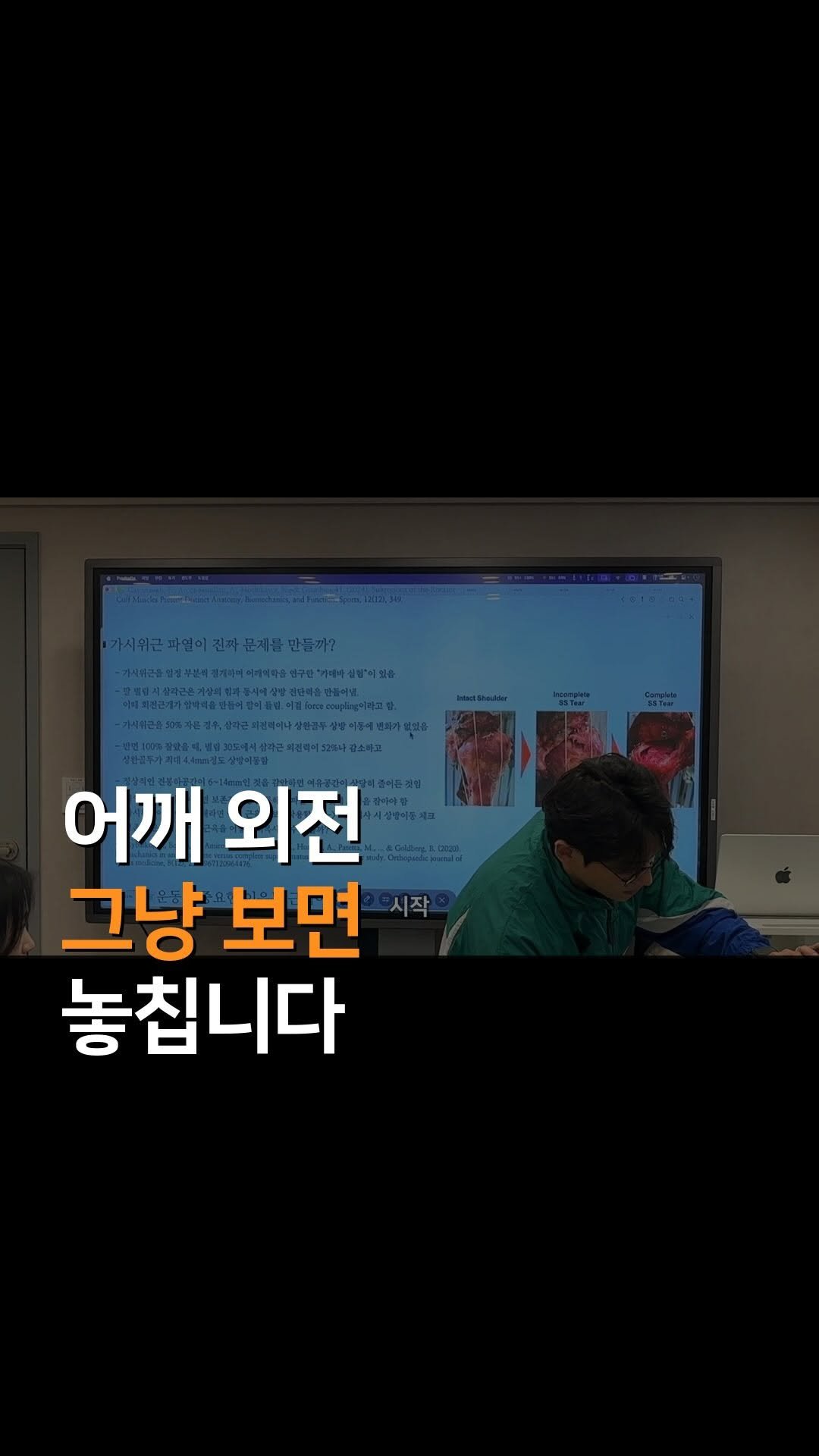anatomy_n_training 게시물 이미지: [어깨 외전 평가]

어깨 외전 평가를 할 때
팔을 올리는 것만 보면 놓치는 게...