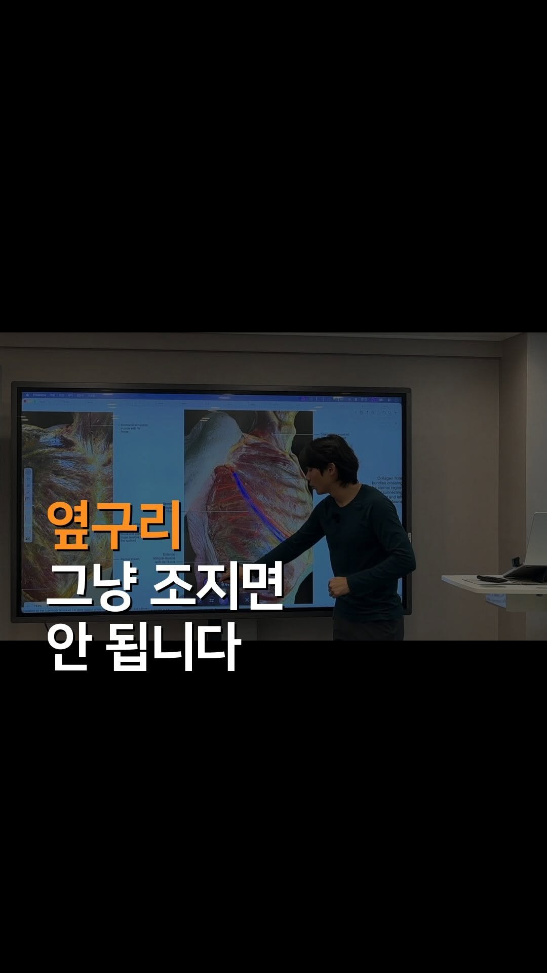 anatomy_n_training 게시물 이미지: [운동 전 폼롤러 꿀팁]

몸에 저런 곳 많음.

근육 결이 다르다는 건 
움직임...