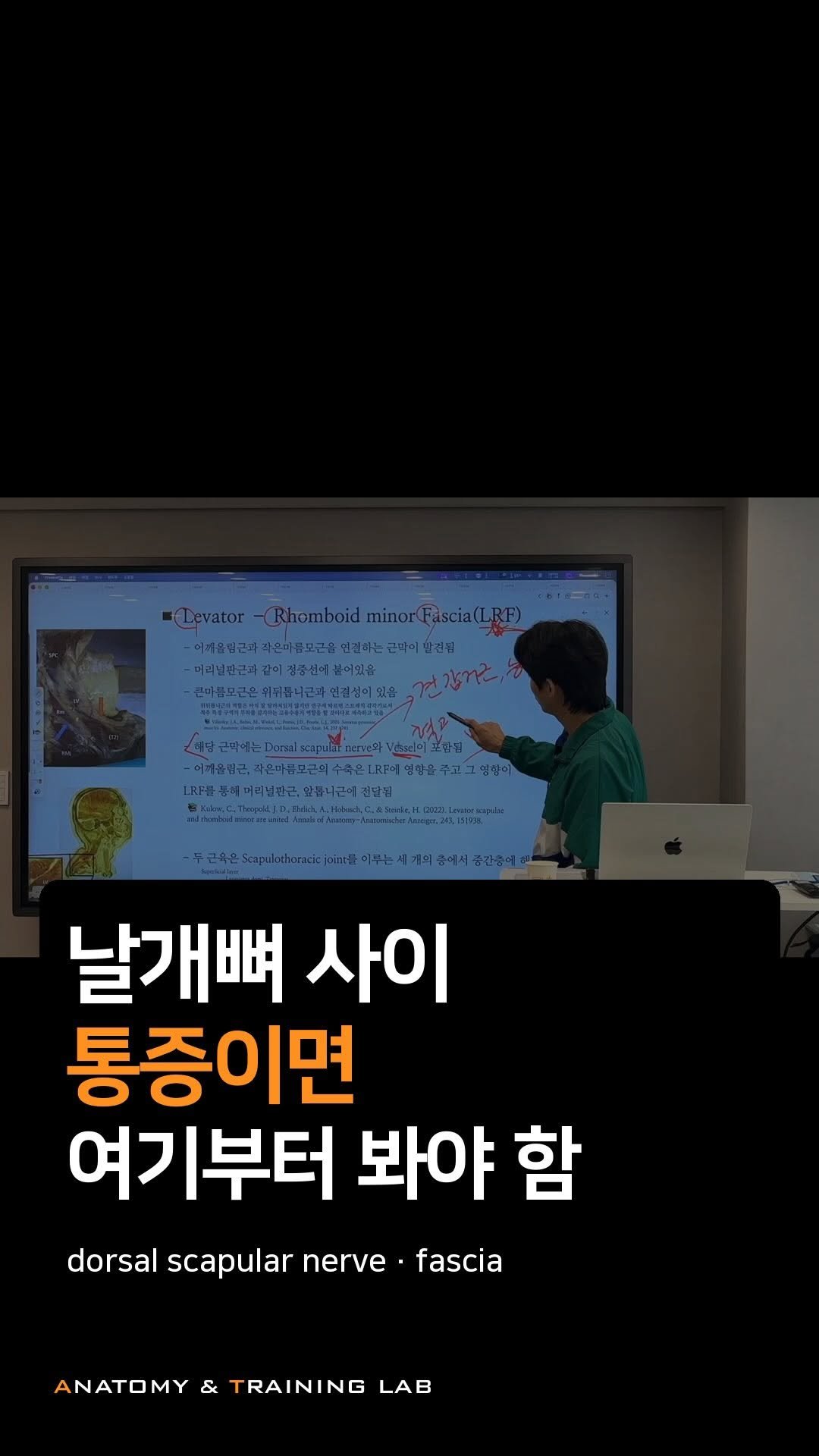 anatomy_n_training 게시물 이미지: 날개뼈 사이 통증을 단순히

“능형근이 약하다”로 끝내면 놓치는 게 많음