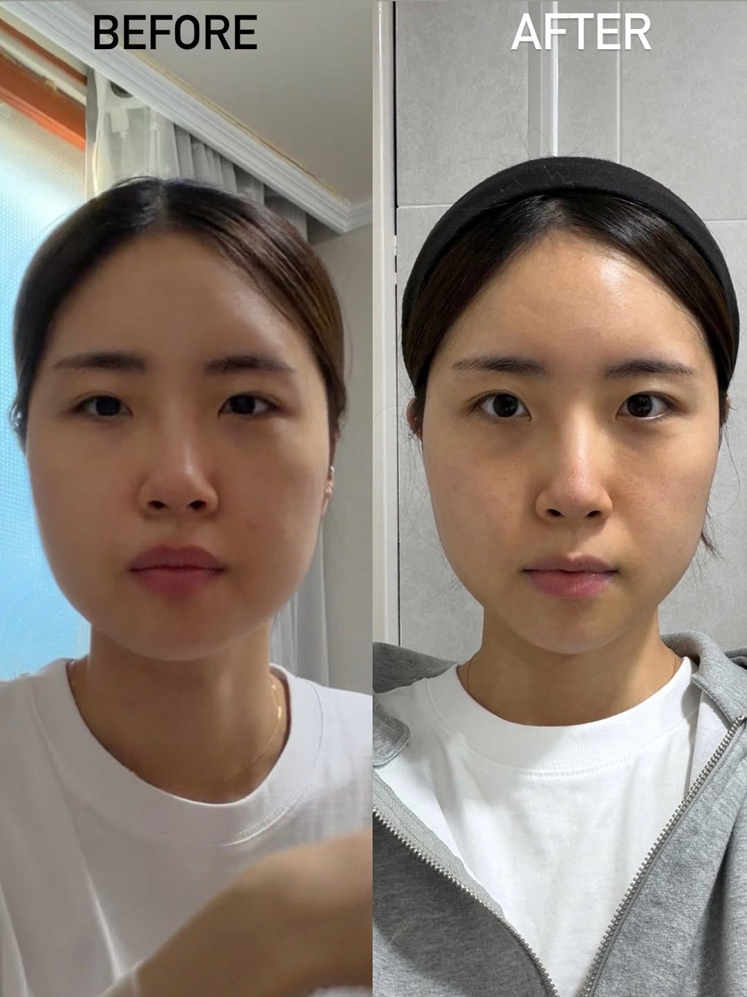 Photo by 앙꼬수지 on November 30, 2025. May be an image of one or more people and text that says 'BEFORE AFTER'.