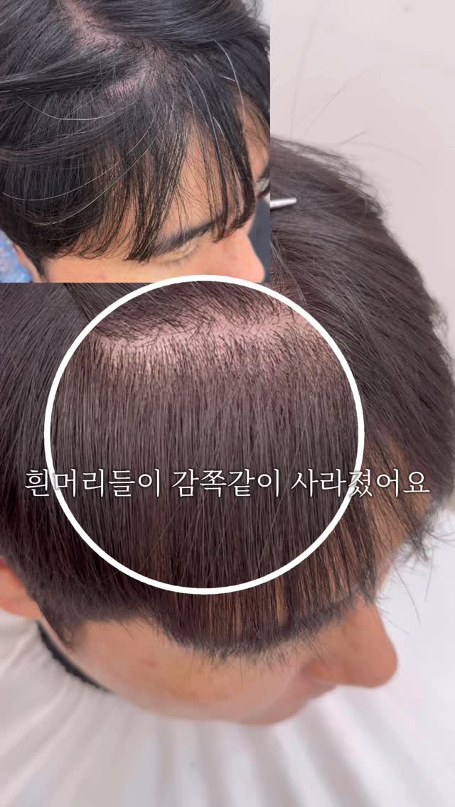 anotherz_saebyuk 게시물 이미지: 사사키에서 새로 출시된 하이커버라인 ! 

7Lv~11Lv 밝은 새치커버가 가능한...