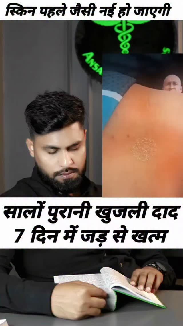 ansari_healthtips 게시물 이미지: सालों पुरानी खुजली ख़त्म #SkinCare #itching...