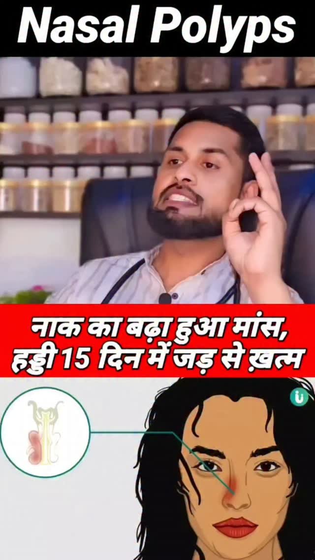 ansari_healthtips 게시물 이미지: नाक का बढ़ा हुआ मांस बढ़ी हूँ हड्डी ख़त्म 
Nasal...