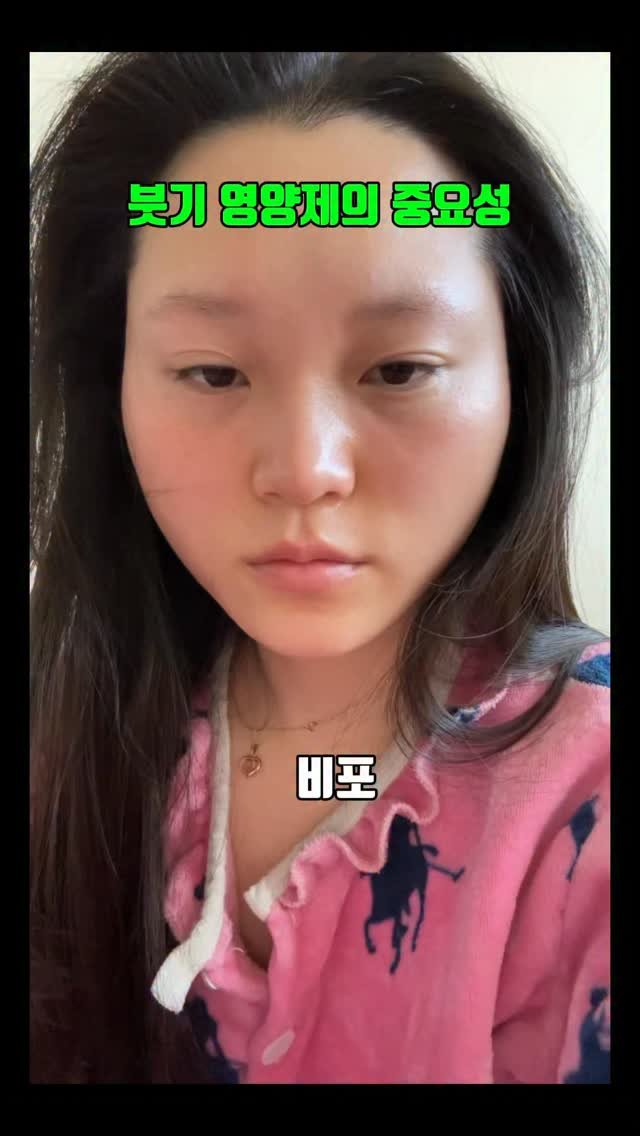 anti_aging__ 게시물 이미지: 박태운 내과 전문의가 만든 붓기템
국내 최초 독소 다이어트 성분 개발에 성공한...