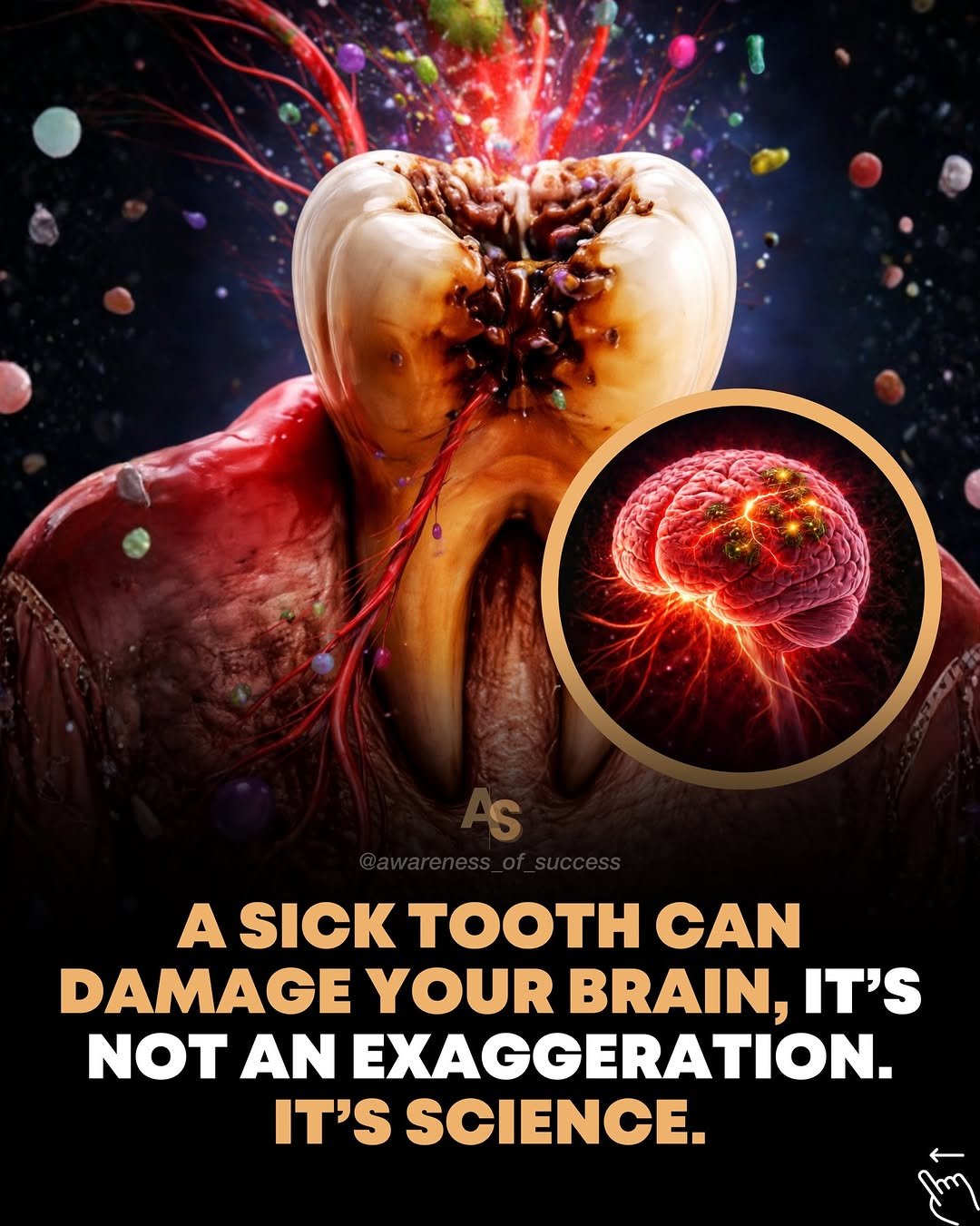 Photo by Awareness • Mindset • Success • AI • Tech on March 04, 2026. May be an image of ‎xray, dental floss and ‎text that says '‎A SICK TOOTH SICKTOOTHCAN CAN DAMAGE YOUR BRAIN, IT'S NOT AN EXAGGERATION, IT'S SCIENCE. أكسا‎'‎‎.