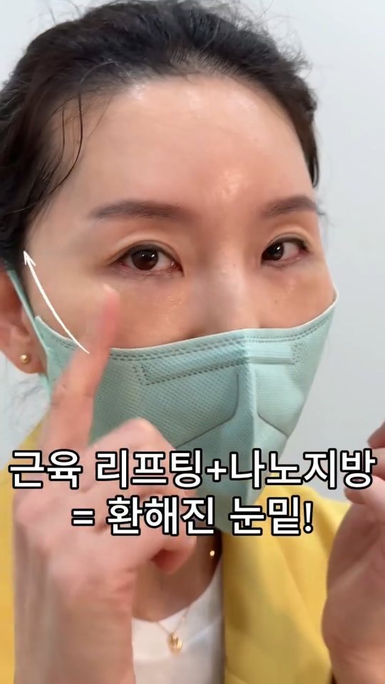 b4fps_official 게시물 이미지: 지방재배치? 하안검? 너무 어려운 용어들...
지방.근육.피부. 어떤 성분이...