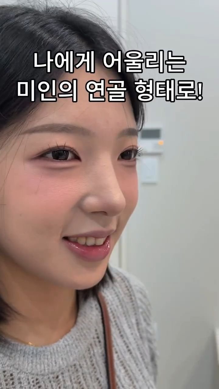 b4fps_official 게시물 이미지: "반듯한 코가 좋아요" 안장+매부리+복코. 비중격만곡증 등 여러가지 요소들이 함께...