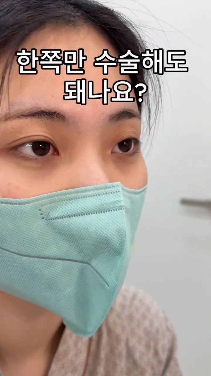 b4fps_official 게시물 이미지: 한쪽 라인은 원래 맘에 들어서 맞추고만 싶은 경우, 하지만 쌍수는 양쪽을 다...