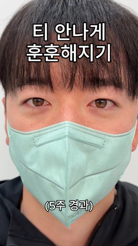 b4fps_official 게시물 이미지: ​게슴츠레하고 피곤해 보이던 +비대칭 눈매에서 훈남 만들기😌
사실 너무 지나치게...